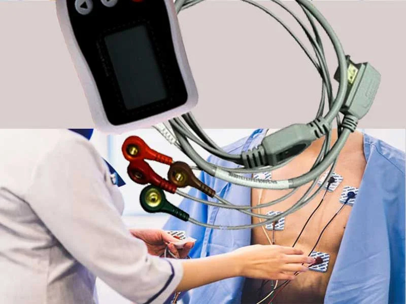 Holter Monitoring